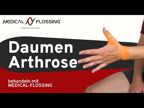 Osteoarthritis in the thumb (rhizal osteoarthritis) – treat with MEDICAL FLOSSING!