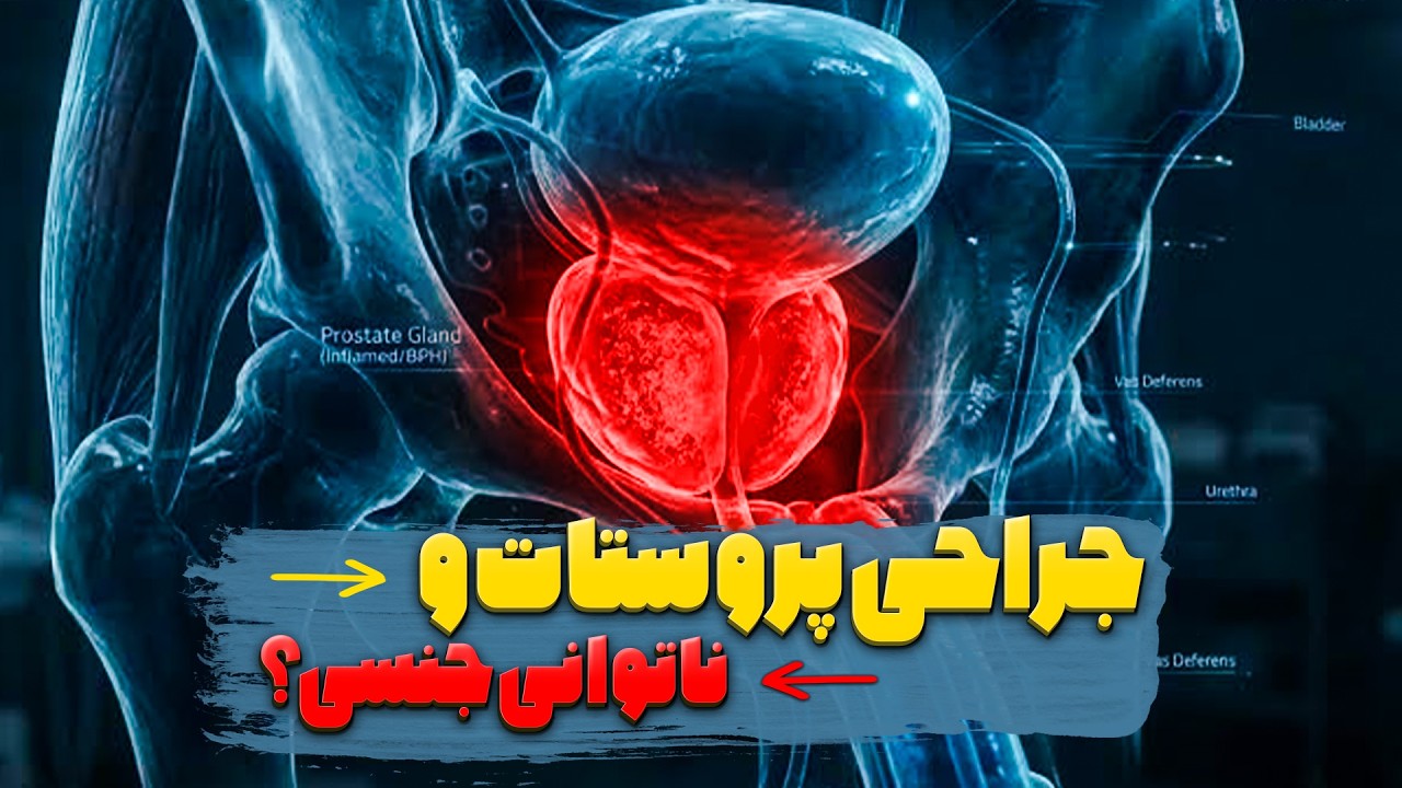 آیا جراحی پروستات باعث ناتوانی جنسی می‌شود؟ (حقایق مهم درباره پروستات) | طبیب