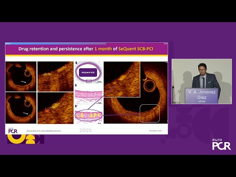 From theory to practice: the versatility of drug-coated balloons around the world - EuroPCR 2025