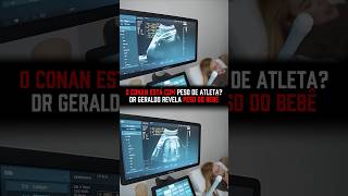 CONAN esta com PESO de ATLETA? DR GERALDO revela o PESO do BEBÊ! #juliobalestrin #conan #bebê #peso