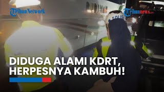 Kisah Polisi Tolong Wanita Menangis, Diduga Alami KDRT tapi ternyata Penyakit Herpesnya Kambuh!