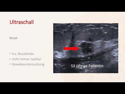 Krebsfrüherkennung - Frauenarztpraxis am Potsdamer Platz - Dr. Matthias Stroth & Natalia Egorova