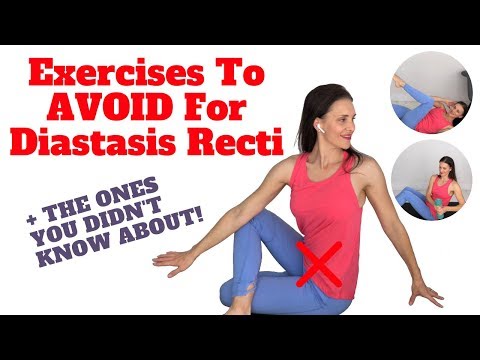 Exercises To Avoid Diastasis Recti
