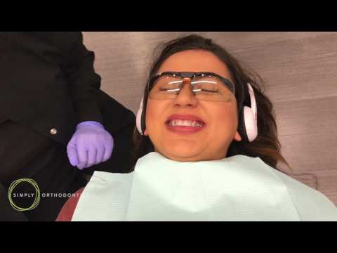 Irvine Orthodontist Shows How to Put on Braces