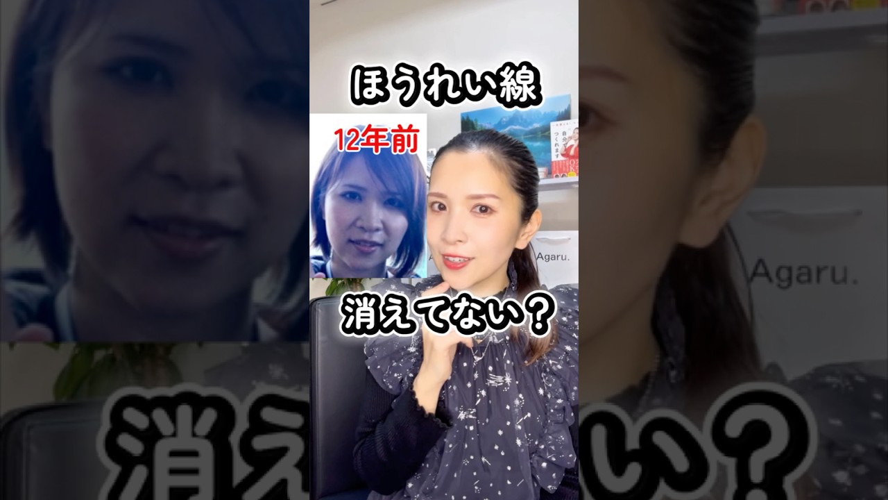 ほうれい線消えてない！？？