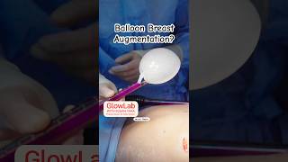 Using a balloon for breast augmentation? @kellykilleenmd explains Preservé by Motiva.