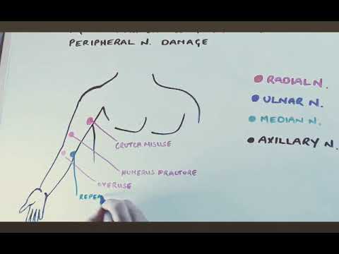 Common locations for peripheral nerve injury in the arm