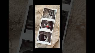 TW: missed miscarriage    #shorts #pregnancyjourney #miscarriage #pregnancy #loss