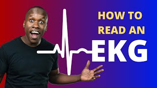 How to Read an EKG (Made Easy)