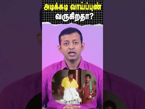 அடிக்கடி வாய்ப்புண் வருகிறதா? | What causes frequent mouth ulcers? | Dr. Arunkumar