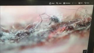 Nano Dust **It's inside all of us* Ulf Diestelmann from Montreal*