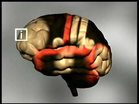 Met mij is niks mis, uitleg dementie, ingekorte versie