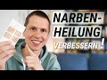 Narbenheilung mit diesem einfachen Trick verbessern! (Crosstape/Gittertape/Akupunkturpflaster)