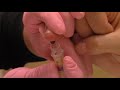 TEDDY Finger Poke Instructional Video