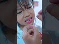 Papoy Copotin Gigi Aletha Pakai Tali Alethaabew