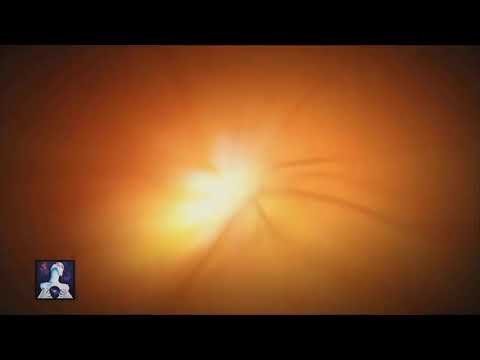 Wilhelm REICH - ORGONE ENERGY