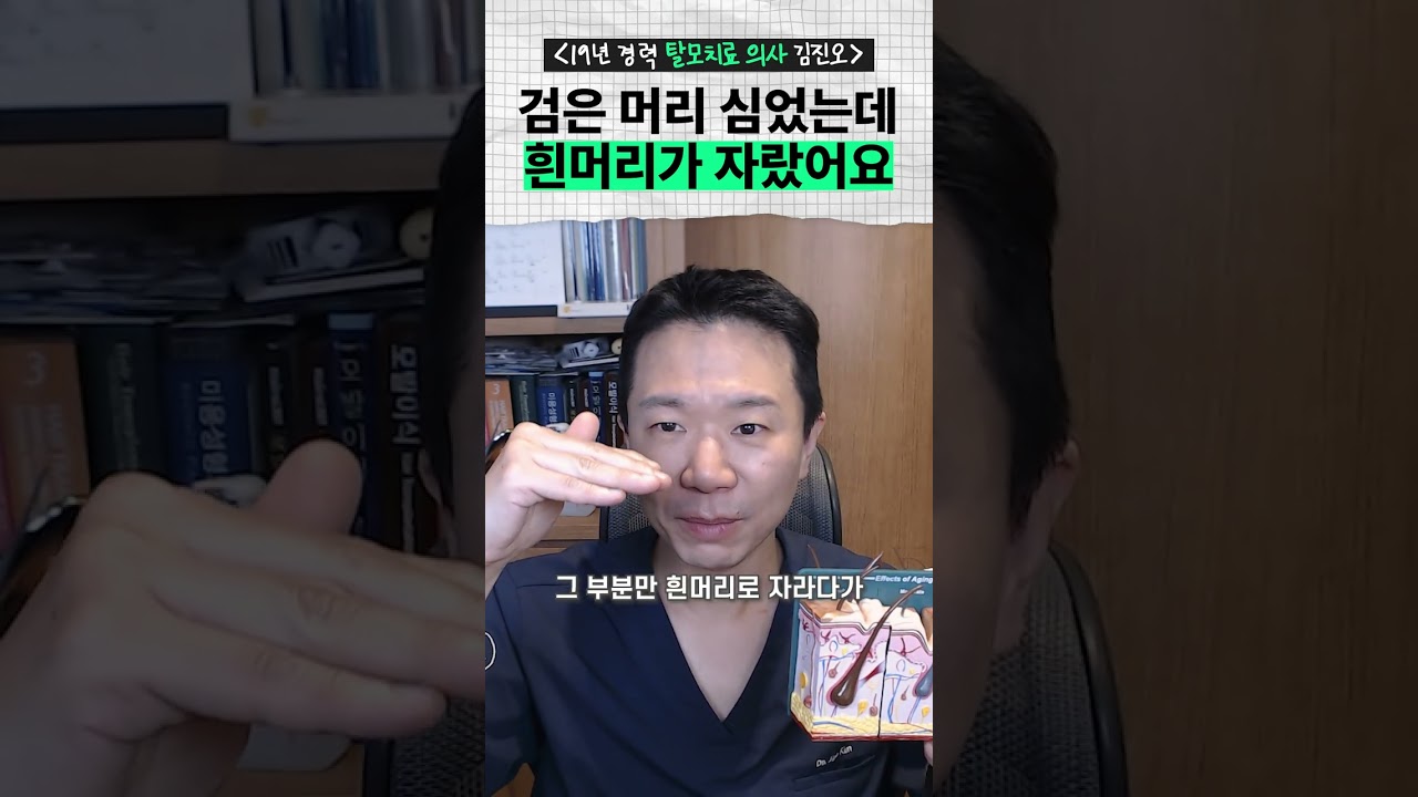 做了头发移植，发际线突然变成了白发。 | 数千例中有两次是罕见的副作用