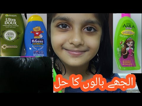 Tangled hair/kids hair care/Dabur Amla Kids Detangler/Hair nourishing