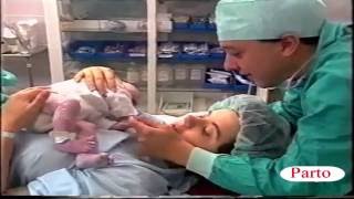 nacimiento o parto con ventosa, extracción placenta  y episiotomía