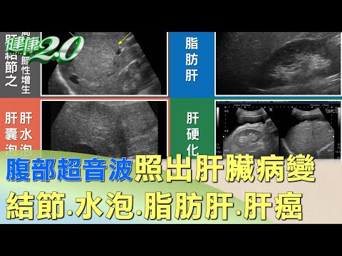 肝長東西