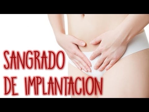 El sangrado de implantación El sangrado de implantación