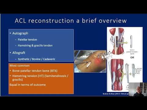 ACL rehabilitation guidelines - a guide for therapists & patients