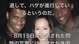 【悲報】平野綾がハゲた？生え際が後退し顔半分がおでこに！