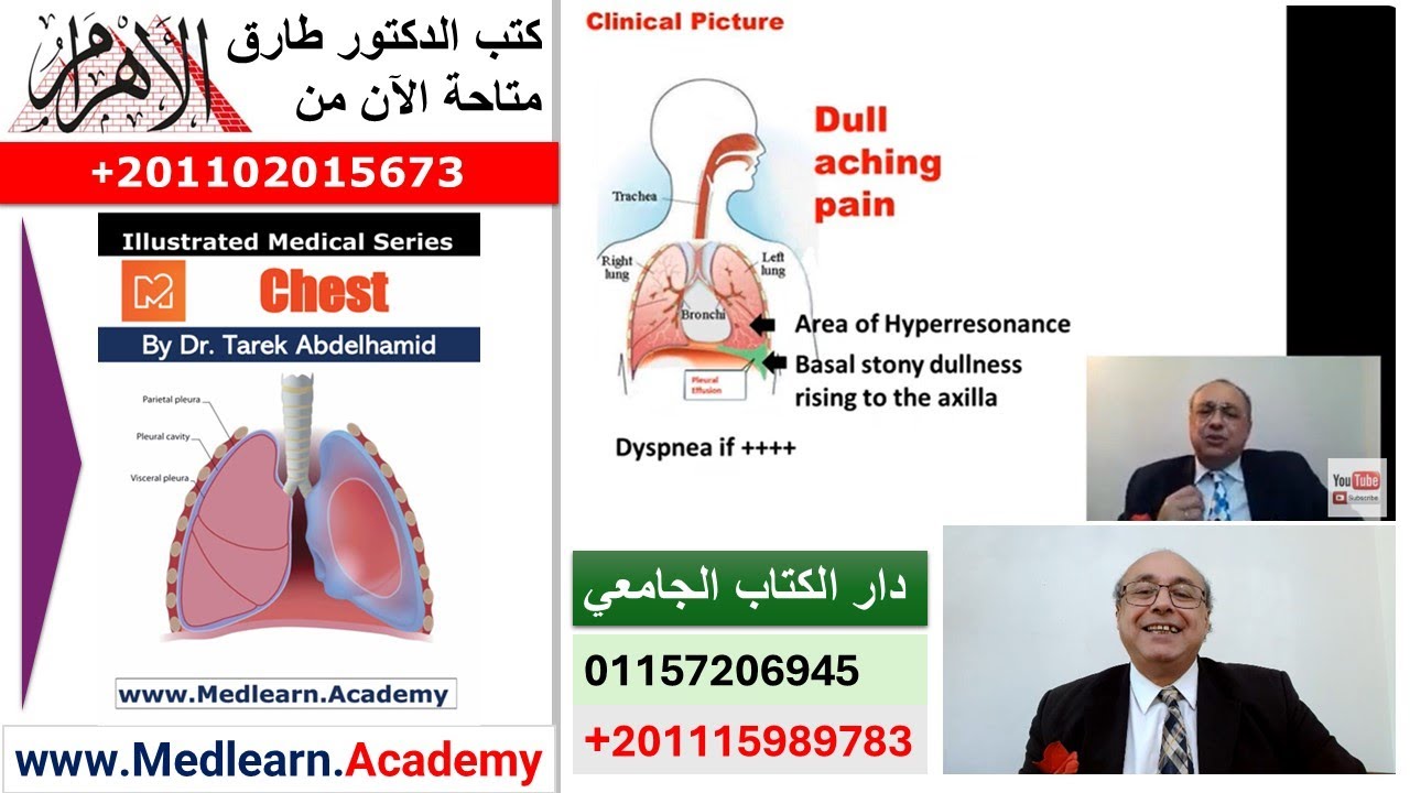 Pleural Effusion #cme #internal_medicine #medical #usmle #محاضرات_باطنة