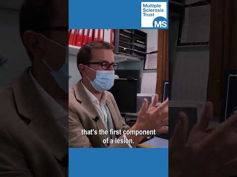 What is a lesion? #shorts #MultipleSclerosis #MS #MSSymptoms