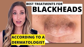 Blackheads: Dermatologist Shares Best Treatments to Remove T