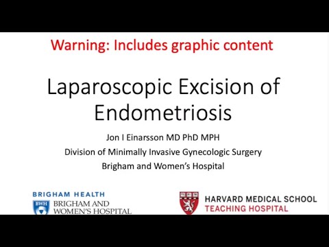 Laparoscopic Excision of Endometriosis - Brigham and Women's Hospital