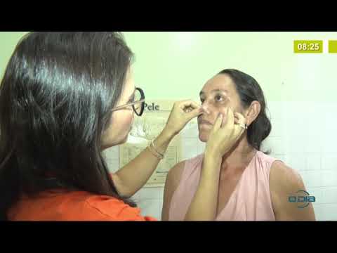 BOM DIA NEWS 09 12 2019  HGV: Campanha de combate ao câncer de pele