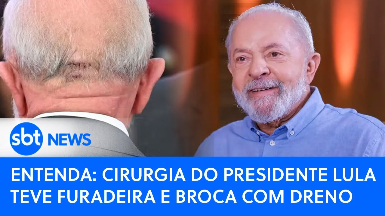 Entenda: Cirurgia do presidente Lula teve furadeira e broca com dreno