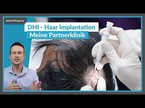 Hair transplantation with DHI – My experience & clinic recommendation as an expert in Turkey