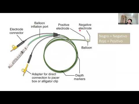 Cardiología - Generalidades de marcapaso