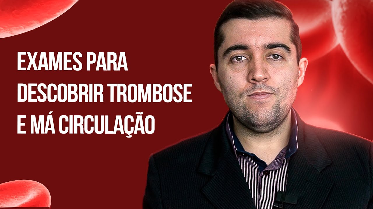 Saiba quais exames fazer para descobrir se você tem uma trombose e como está a sua circulação