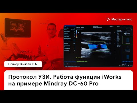 Работа функции iWorks на примере Mindray DC-60 Pro Работа функции iWorks на примере Mindray DC-60 Pro