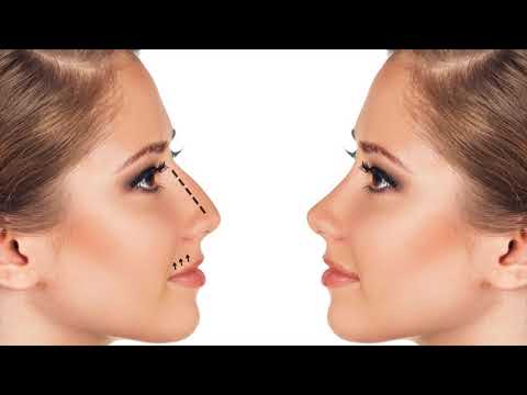 download lagu mp3 mp4 How To Not Sleep With Your Mouth Open, download lagu How To Not Sleep With Your Mouth Open gratis, unduh video klip How To Not Sleep With Your Mouth Open