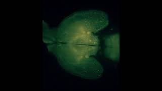 Download lagu iDISCO brain after Cocaine mp3 Download lagu iDISCO brain after Cocaine mp3