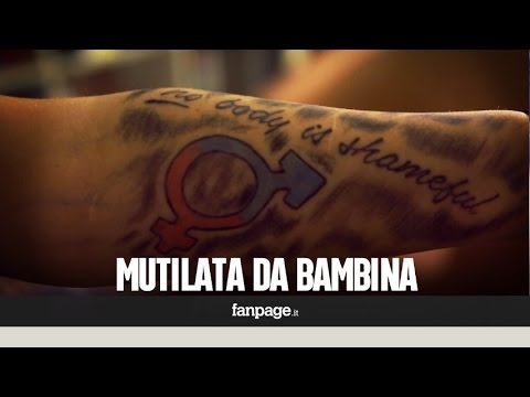 Decolorazione della persona per mezzo di latte Pigmentazione di pelle di faccia dopo la consegna