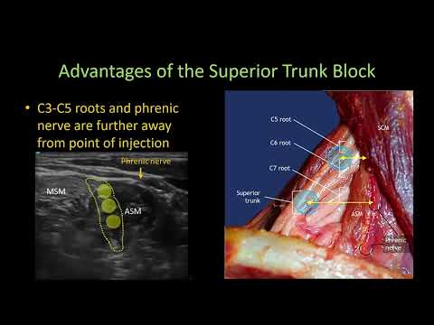 Advantages of the SUPERIOR TRUNK BLOCK