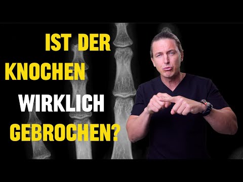 Trauma surgeon: How do I recognize a fracture?