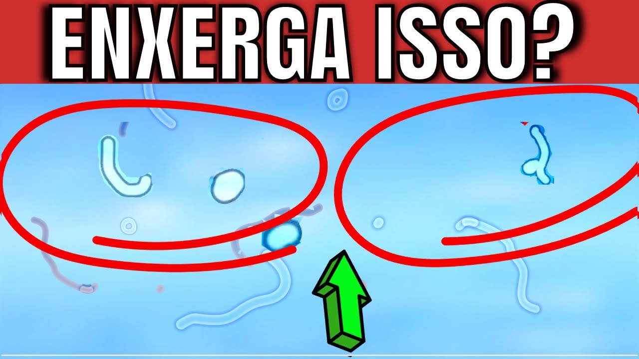 Why do you see DIRT floating in your eyes? How to END them (naturally)? (eye floaters)
