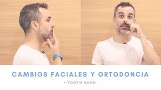 TOOTH BOSS || ¿La ORTODONCIA puede cambiarme la CARA 😱|| Ortodoncia en Murcia