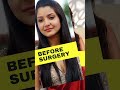 AnushkaSharma Before And After PlasticSurgery Can You Guess Which Surgery She Got Done Shorts