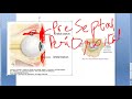 Ophthalmology 417 a Orbital Infection Orbital Cellulitis PreSeptal Post Septal Eye Swelling