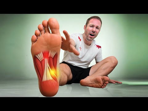 Your Plantar Fasciitis Treatment Is Wrong (Here's Why)