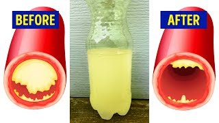 15 Foods That Reduce Your Heart Attack Risk by 80%