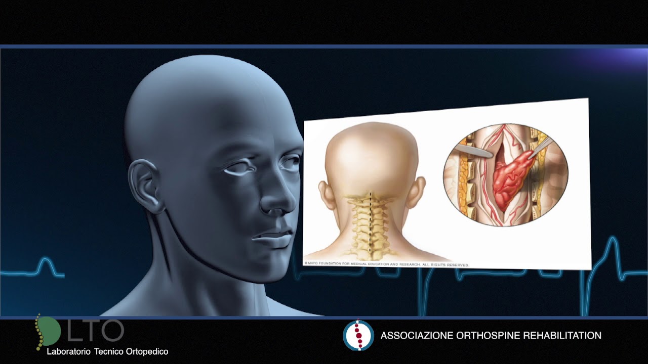 Giovanni Cardarelli-1