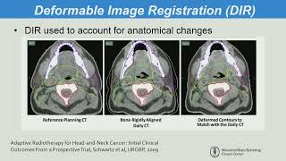 SRS/SBRT Treatment Fields: Image Regisration, Fusion Algorithm, and Dose Accumulation